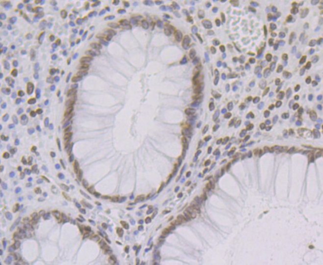 UNC84B Antibody in Immunohistochemistry (Paraffin) (IHC (P))