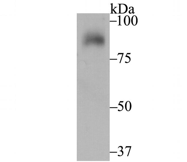 UNC84B Antibody in Western Blot (WB)