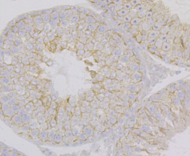 Nectin 2 Antibody in Immunohistochemistry (Paraffin) (IHC (P))