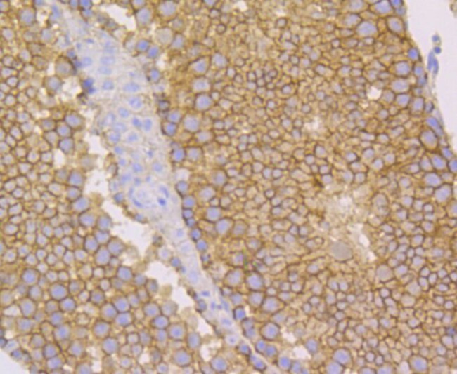 Nectin 2 Antibody in Immunohistochemistry (Paraffin) (IHC (P))