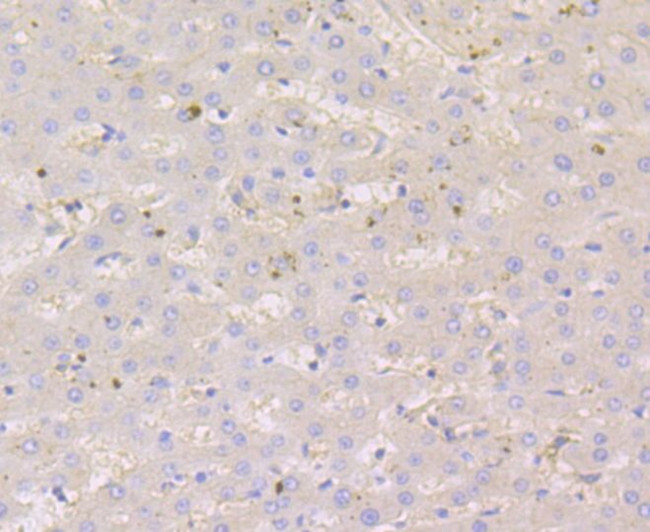 Nectin 2 Antibody in Immunohistochemistry (Paraffin) (IHC (P))