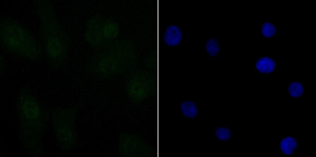 CtBP1 Antibody in Immunocytochemistry (ICC/IF)