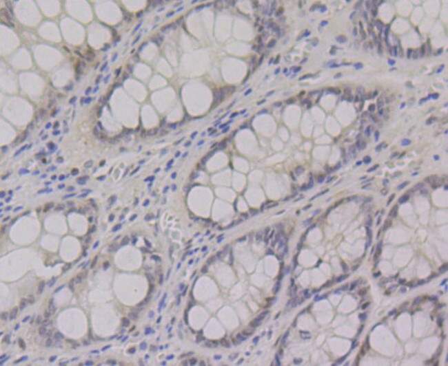 CtBP1 Antibody in Immunohistochemistry (Paraffin) (IHC (P))