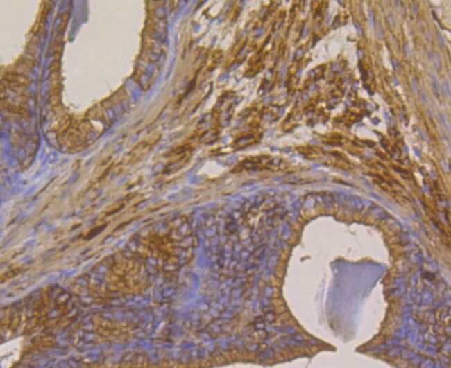 METAP2 Antibody in Immunohistochemistry (Paraffin) (IHC (P))