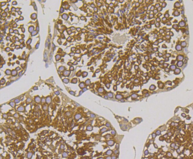 METAP2 Antibody in Immunohistochemistry (Paraffin) (IHC (P))