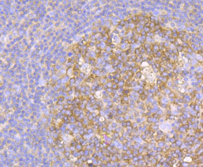 METAP2 Antibody in Immunohistochemistry (Paraffin) (IHC (P))