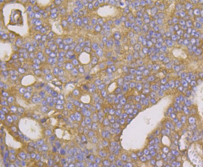 METAP2 Antibody in Immunohistochemistry (Paraffin) (IHC (P))