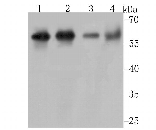 METAP2 Antibody in Western Blot (WB)