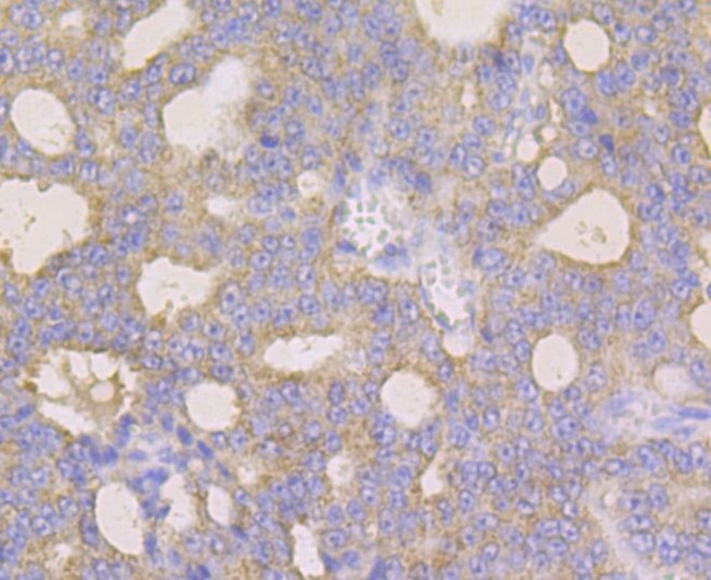 Monoamine Oxidase B Antibody in Immunohistochemistry (Paraffin) (IHC (P))