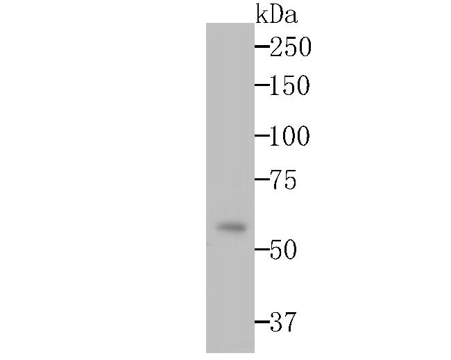 Monoamine Oxidase B Antibody in Western Blot (WB)