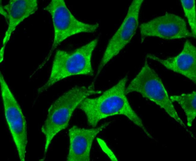 SNX1 Antibody in Immunocytochemistry (ICC/IF)