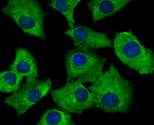 SNX1 Antibody in Immunocytochemistry (ICC/IF)