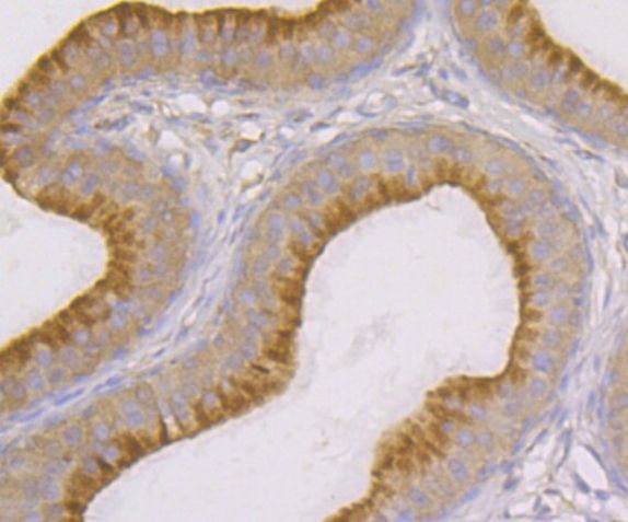 SNX1 Antibody in Immunohistochemistry (Paraffin) (IHC (P))