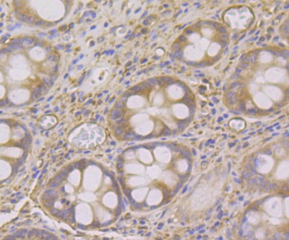 SNX1 Antibody in Immunohistochemistry (Paraffin) (IHC (P))