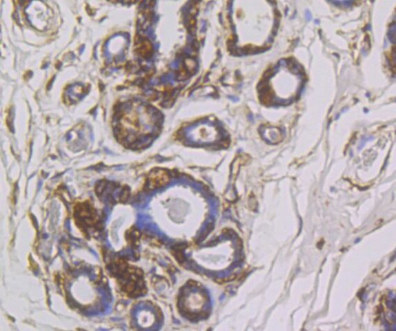 SNX1 Antibody in Immunohistochemistry (Paraffin) (IHC (P))