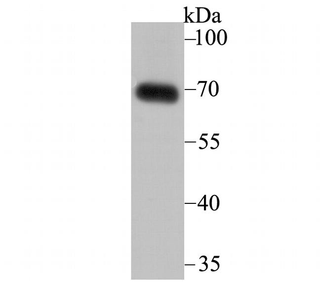 SNX1 Antibody in Western Blot (WB)