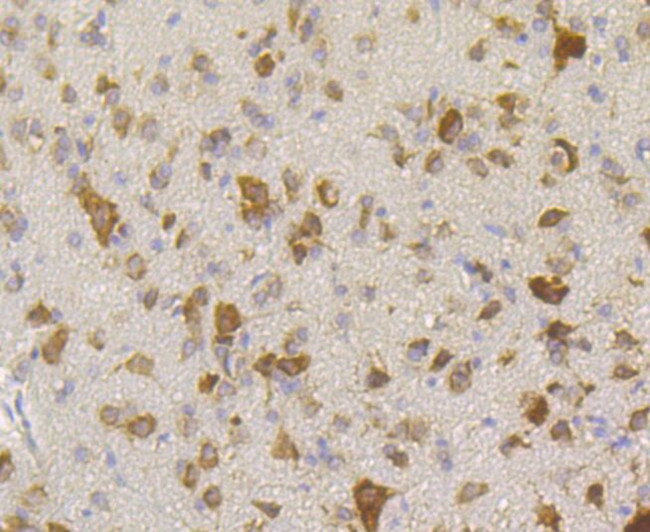 RACK1 Antibody in Immunohistochemistry (Paraffin) (IHC (P))