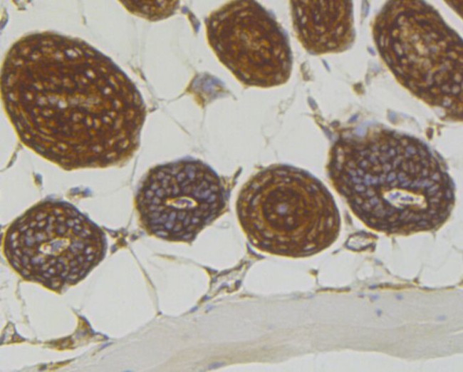 RACK1 Antibody in Immunohistochemistry (Paraffin) (IHC (P))