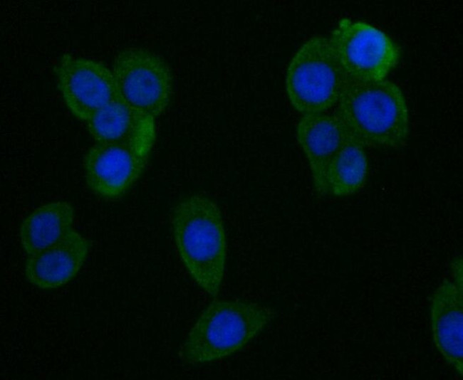 CYP27A1 Antibody in Immunocytochemistry (ICC/IF)