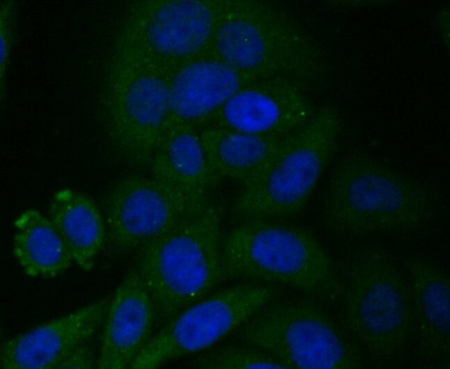 CYP27A1 Antibody in Immunocytochemistry (ICC/IF)