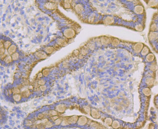 CYP27A1 Antibody in Immunohistochemistry (Paraffin) (IHC (P))