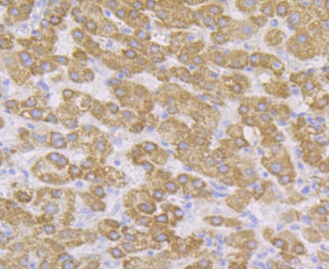 CYP27A1 Antibody in Immunohistochemistry (Paraffin) (IHC (P))