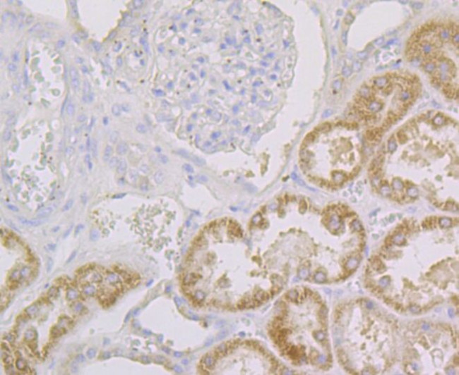 CYP27A1 Antibody in Immunohistochemistry (Paraffin) (IHC (P))