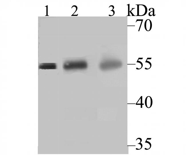 CYP27A1 Antibody in Western Blot (WB)