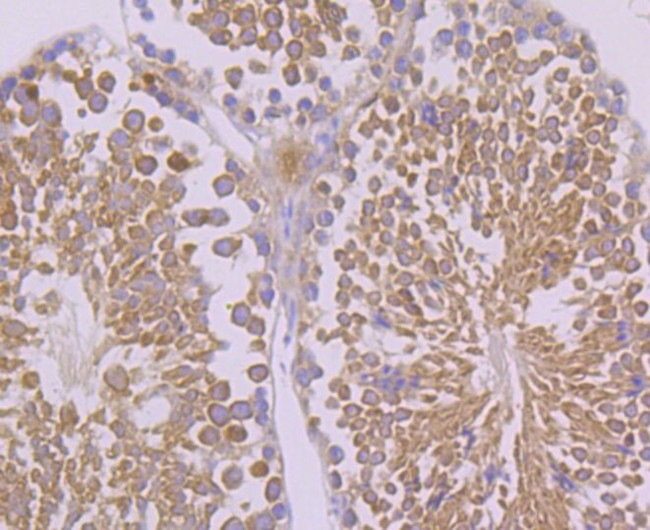 FAAH Antibody in Immunohistochemistry (Paraffin) (IHC (P))