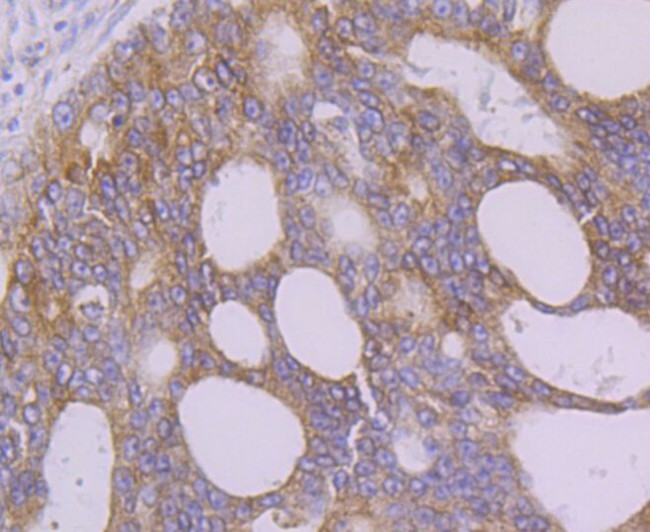 FAAH Antibody in Immunohistochemistry (Paraffin) (IHC (P))