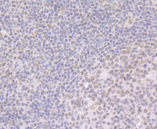 BRD2 Antibody in Immunohistochemistry (Paraffin) (IHC (P))