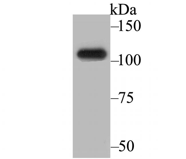 BRD2 Antibody in Western Blot (WB)