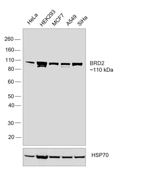 BRD2 Antibody in Western Blot (WB)