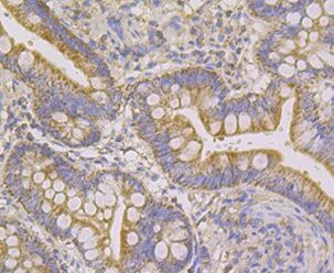 NDUFS4 Antibody in Immunohistochemistry (Paraffin) (IHC (P))