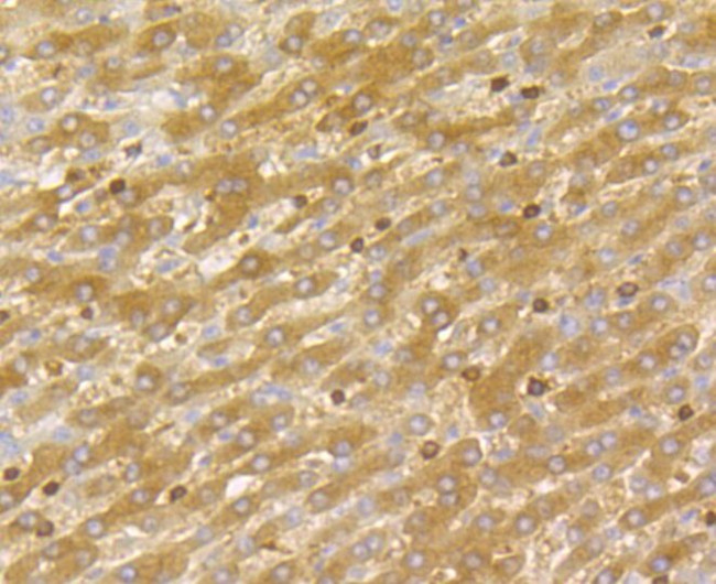 DIAPH1 Antibody in Immunohistochemistry (Paraffin) (IHC (P))