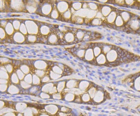 DIAPH1 Antibody in Immunohistochemistry (Paraffin) (IHC (P))