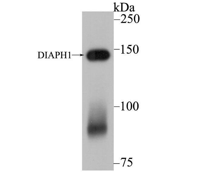 DIAPH1 Antibody in Western Blot (WB)