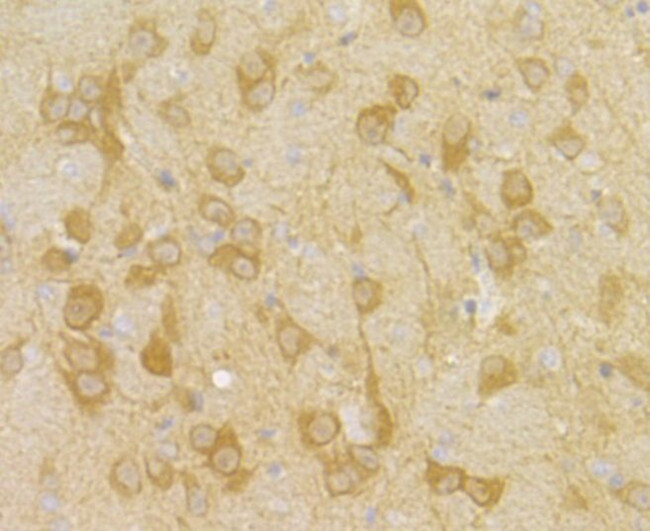 PGAM1 Antibody in Immunohistochemistry (Paraffin) (IHC (P))