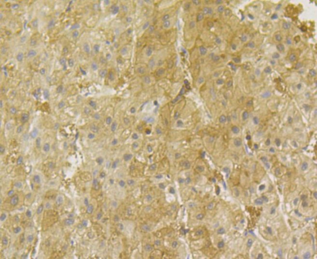 PGAM1 Antibody in Immunohistochemistry (Paraffin) (IHC (P))