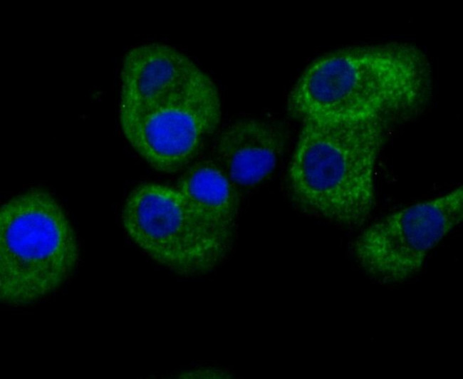 FIS1 Antibody in Immunocytochemistry (ICC/IF)