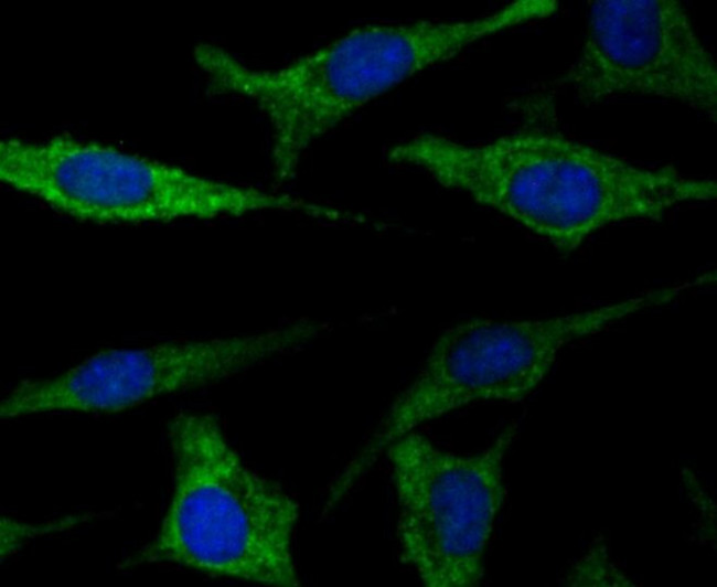 FIS1 Antibody in Immunocytochemistry (ICC/IF)