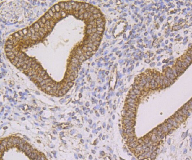 FIS1 Antibody in Immunohistochemistry (Paraffin) (IHC (P))