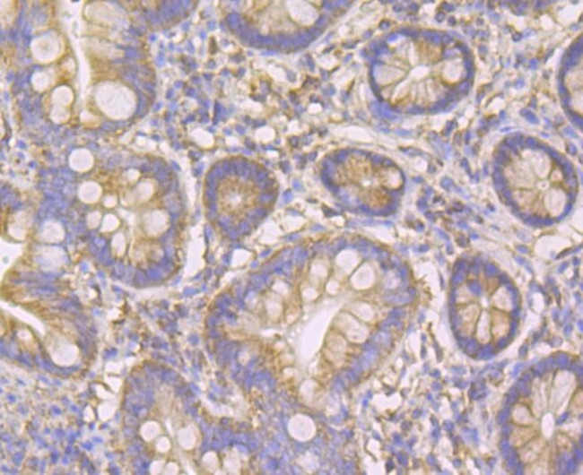 FIS1 Antibody in Immunohistochemistry (Paraffin) (IHC (P))