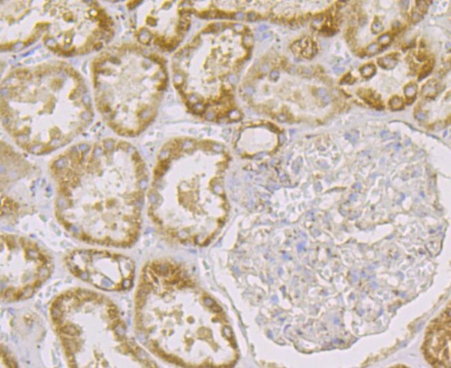 FIS1 Antibody in Immunohistochemistry (Paraffin) (IHC (P))