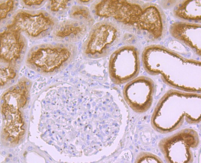 Syntaxin 3 Antibody in Immunohistochemistry (Paraffin) (IHC (P))