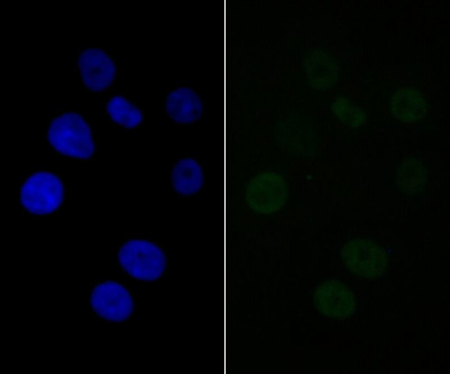 BAF57 Antibody in Immunocytochemistry (ICC/IF)