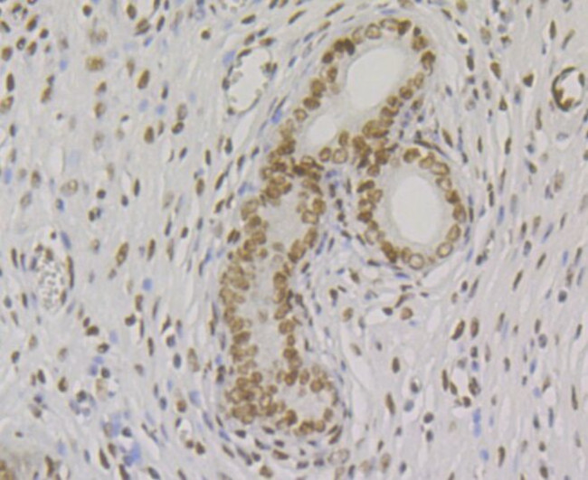 BAF57 Antibody in Immunohistochemistry (Paraffin) (IHC (P))