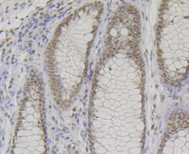 BAF57 Antibody in Immunohistochemistry (Paraffin) (IHC (P))