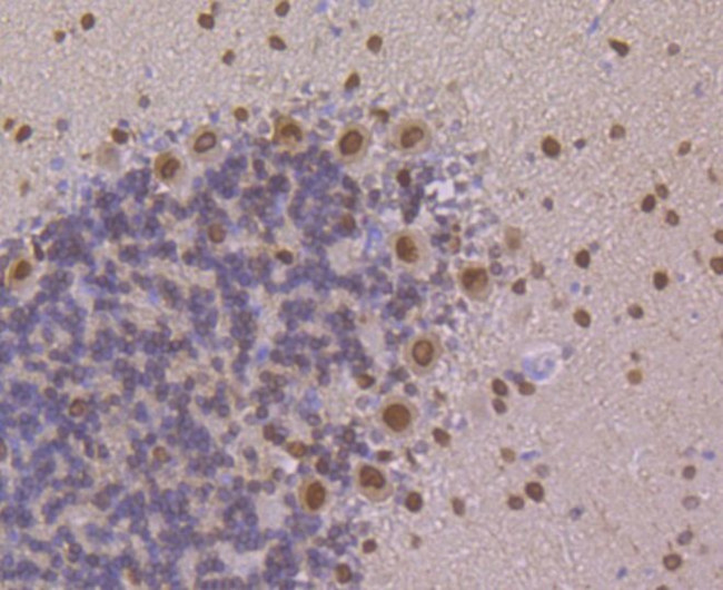 PEN2 Antibody in Immunohistochemistry (Paraffin) (IHC (P))