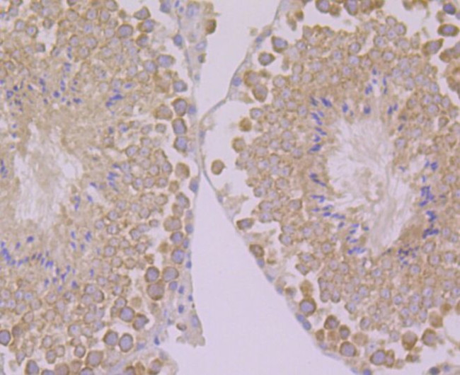 PEN2 Antibody in Immunohistochemistry (Paraffin) (IHC (P))